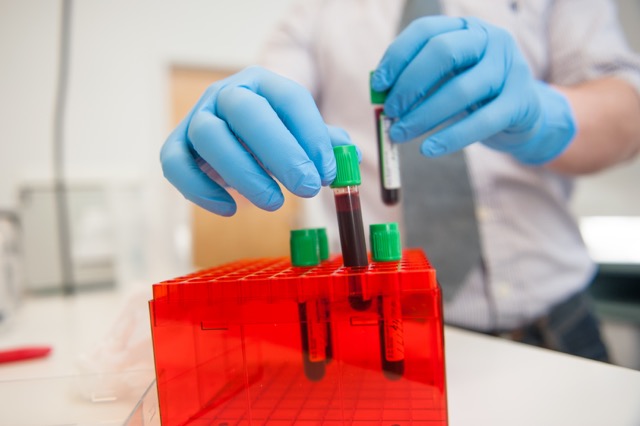 Lab Sample Collection